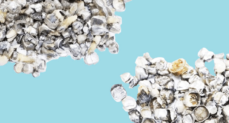 歯科金属スクラップの買取